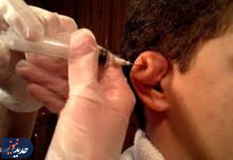 گوش گل کلمی و خشونت نمایشی با تزریق آمپول در آرایشگاه ها
