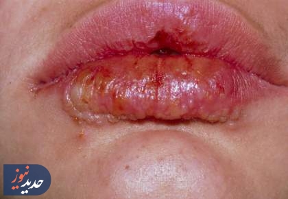 عمل زیبایی در صدر شکایات قصور پزشکی است